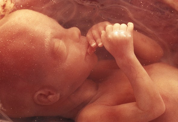 The call for an ethical conversion: seeing the faces of the&nbsp;pre-born